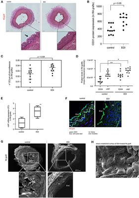 A Novel Endothelial Damage Inhibitor Reduces Oxidative Stress and Improves Cellular Integrity in Radial Artery Grafts for Coronary Artery Bypass